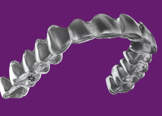Transparente Aligner – ästhetische Zahnkorrektur