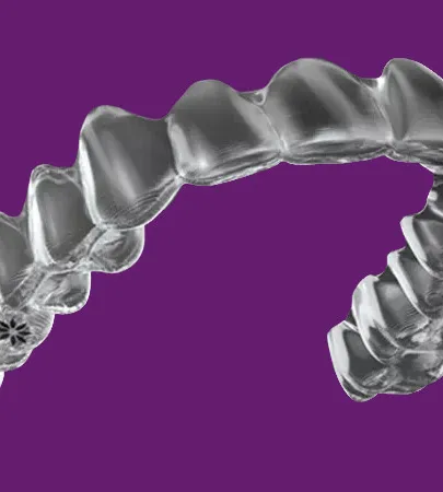 Unsichtbare Zahnschiene (Aligner)